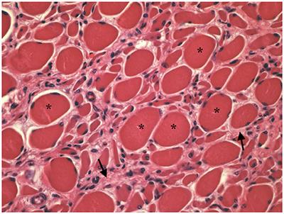 Spinal Muscular Atrophy in Blonde D'Aquitaine Calves Is Not Associated With FVT1 Gene Mutation